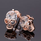 Aretes de Cráneo